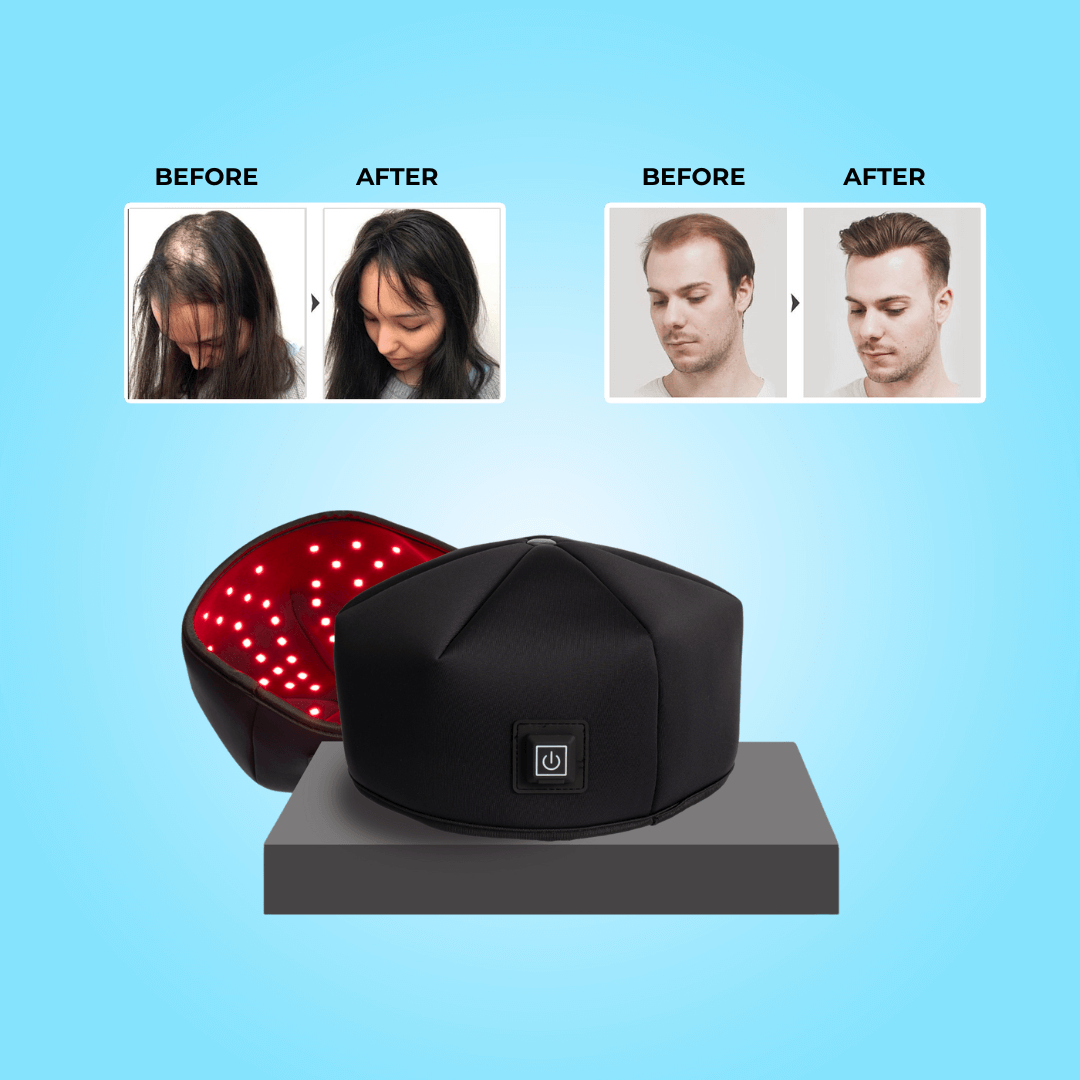 ReGain - Laser Hair Growth System Cap